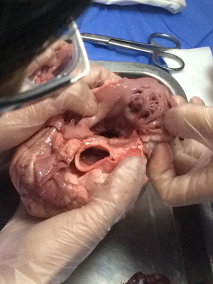 两位老师从心脏大体,组织结构,血管分布到左,右冠状动脉开口,左右心